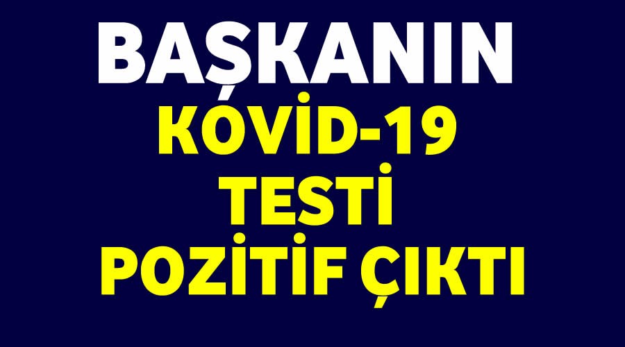 Bakannn Covid-19 testi pozitif kt